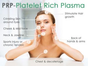 PRP platelet rich plasma