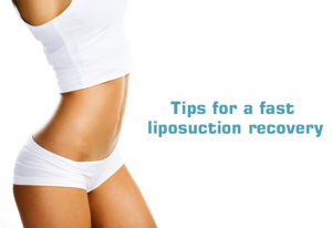 Liposuction Recovery Tips